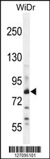 Anti-ZNF180 Rabbit Polyclonal Antibody