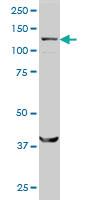 Anti-SMC6 Mouse Monoclonal Antibody