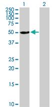 Anti-ALDH3A1 Mouse Polyclonal Antibody