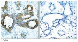 Anti-PAK1 Rabbit Polyclonal Antibody