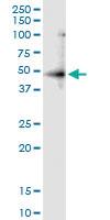 Anti-RNF113B Rabbit Polyclonal Antibody