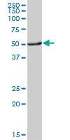 Anti-ALDH3A1 Mouse Polyclonal Antibody