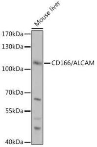 Western blot analysis of extracts of Mouse liver, using Anti-CD166 Antibody (A9007) at 1:1,000 dilution The secondary antibody was Goat Anti-Rabbit IgG H&L Antibody (HRP) at 1:10,000 dilution Lysates/proteins were present at 25 µg per lane