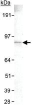 Anti-SLC9A8 Mouse Monoclonal Antibody [clone: 7A11]