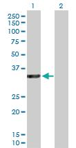 Anti-RASSF5 Rabbit Polyclonal Antibody