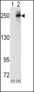 Anti-ALK Rabbit Polyclonal Antibody