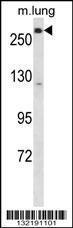 Anti-LRP5 Rabbit Polyclonal Antibody (HRP (Horseradish Peroxidase))