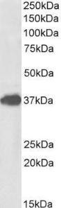 Anti-FOXF1 Antibody (A85145) (1 µg/ml) staining of Mouse Lung lysate (35 µg protein in RIPA buffer). Primary incubation was 1 hour. Detected by chemiluminescence