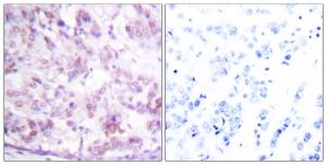 Anti-v-Myb + c-Myb Rabbit Polyclonal Antibody