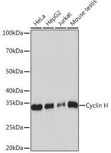 Western blot analysis of extracts of various cell lines, using Anti-Cyclin H/p34 Antibody [ARC0893] (A305324) at 1:1000 dilution. The secondary Antibody was Goat Anti-Rabbit IgG H&L Antibody (HRP) at 1:10000 dilution.