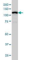 Anti-GABBR1 Mouse Monoclonal Antibody [clone: 2D7]