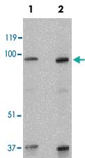 Anti-SKI Rabbit Polyclonal Antibody