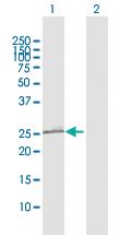 Anti-OIP5 Rabbit Polyclonal Antibody