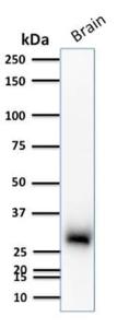 Western blot analysis of human brain tissue lysate using Anti-Calretinin Antibody [CALB2/2786]