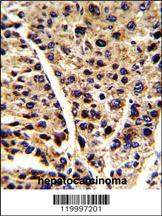 Anti-ENOB Rabbit Polyclonal Antibody