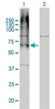 Anti-GABBR1 Mouse Monoclonal Antibody [clone: 2D7]