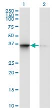 Anti-TSNAXIP1 Mouse Monoclonal Antibody [clone: 1D6]