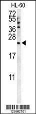 Anti-COQ7 Rabbit Polyclonal Antibody