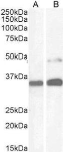 Anti-PAX8 Antibody (A83481) (1 µg/ml) staining of Human Kidney (A) and HeLa cell (B) lysate (35 µg protein in RIPA buffer). Detected by chemiluminescence