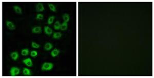 Immunofluorescence analysis of MCF7 cells using Anti-ARFGAP1 Antibody. The right hand panel represents a negative control, where the antibody was pre-incubated with the immunising peptide