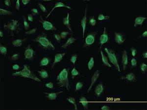 Anti-GABBR1 Mouse Monoclonal Antibody [clone: 2D7]