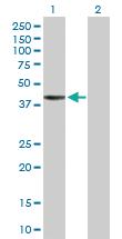 Anti-RNF113B Rabbit Polyclonal Antibody