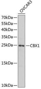 Western blot analysis of extracts of OVCAR-3 cells, using Anti-CBX1/HP1 beta Antibody (A9014) at 1:1,000 dilution