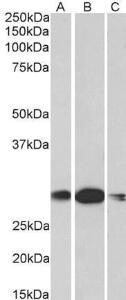 Anti-HOXA5 Antibody (A85146) (1 µg/ml) staining of Human (A), Mouse (B) and rat (C) Kidney lysates (35 µg protein in RIPA buffer). Primary incubation was 1 hour. Detected by chemiluminescence