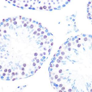 Immunohistochemistry analysis of paraffin-embedded mouse testis using Anti-Cyclin H/p34 Antibody [ARC0893] (A305324) at a dilution of 1:100 (40X lens). Perform microwave antigen retrieval with 10 mM PBS buffer pH 7.2 before commencing with IHC staining protocol