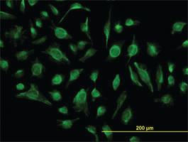 Anti-GABBR1 Mouse Monoclonal Antibody [clone: 2D7]