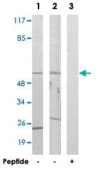 Anti-CYP39A1 Rabbit Polyclonal Antibody