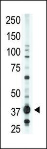 Anti-LPAR1 Rabbit Polyclonal Antibody (AP (Alkaline Phosphatase))