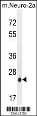 Anti-AP3S1 Rabbit Polyclonal Antibody (APC (Allophycocyanin))