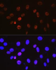 Immunofluorescence analysis of NIH-3T3 cells using Anti-Cyclin H/p34 Antibody [ARC0893] (A305324) at a dilution of 1:100 (40X lens). DAPI was used to stain the cell nuclei (blue)