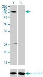 Anti-GABBR1 Mouse Monoclonal Antibody [clone: 2D7]