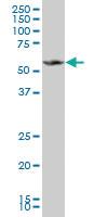 Anti-MPP1 Mouse Monoclonal Antibody [clone: 2E5]