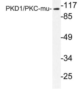 Antibody anti-PKC MU A95572-100 100 µg