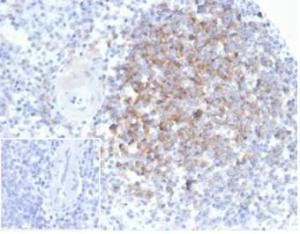 Immunohistochemical analysis of formalin-fixed, paraffin-embedded human spleen tissue using Anti-Interferon alpha 1 Antibody [IFNA/6689] at 2 µg/ml. Inset: PBS instead of the primary Antibody. Secondary Antibody negative control