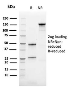 SDS-PAGE analysis of Anti-Calretinin Antibody [CALB2/2786] under non-reduced and reduced conditions; showing intact IgG and intact heavy and light chains, respectively SDS-PAGE analysis confirms the integrity and purity of the antibody