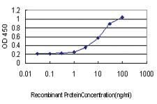 Anti-GABBR1 Mouse Monoclonal Antibody [clone: 2D7]