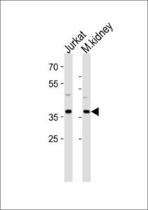 Anti-MAP Kinase 14 Rabbit Polyclonal Antibody (AP (Alkaline Phosphatase))