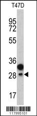 Anti-PROCR Rabbit Polyclonal Antibody