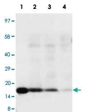 Anti-IL18 Rabbit Polyclonal Antibody