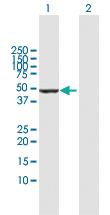 Anti-VIL1 Rabbit Polyclonal Antibody