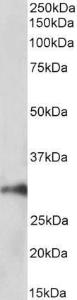 Anti-HOXA5 Antibody (A85147) (1 µg/ml) staining of Pig Kidney lysate (35 µg protein in RIPA buffer). Primary incubation was 1 hour. Detected by chemiluminescence