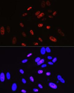 Immunofluorescence analysis of U-2 OS cells using Anti-Cyclin H/p34 Antibody [ARC0893] (A305324) at a dilution of 1:100 (40X lens). DAPI was used to stain the cell nuclei (blue)