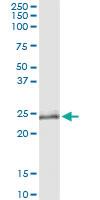 Anti-OIP5 Rabbit Polyclonal Antibody