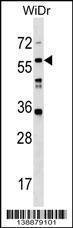 Anti-LRRC14B Rabbit Polyclonal Antibody (PE (Phycoerythrin))