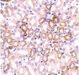 Anti-NPHS1 Rabbit Polyclonal Antibody