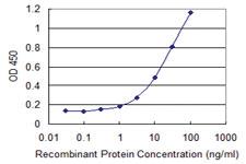 Anti-TSNAXIP1 Mouse Monoclonal Antibody [clone: 1D6]